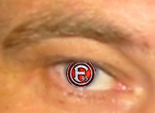 Augen Klaus